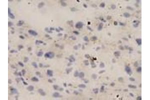 IHC-P analysis of human liver tissue, using IL18 antibody (1/10 dilution). (IL-18 抗体  (full length))