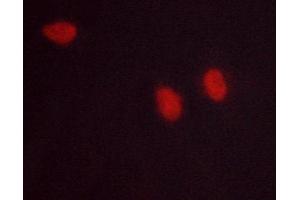 Immunofluorescence (fixed cells) (IF/ICC) image for anti-Nuclear Factor-kB p65 (NFkBP65) antibody (ABIN6263616)