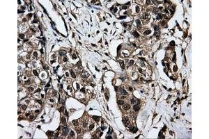 Immunohistochemistry (IHC) image for anti-Dicarbonyl/L-Xylulose Reductase (DCXR) antibody (ABIN1497785) (DCXR 抗体)