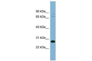 TMEM176A antibody used at 1 ug/ml to detect target protein. (TMEM176A 抗体  (Middle Region))