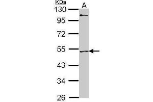 WB Image Sample (30 ug of whole cell lysate) A: H1299 10% SDS PAGE antibody diluted at 1:1000