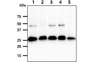 The cell lysates (40ug) were resolved by SDS-PAGE, transferred to PVDF membrane and probed with anti-human SSU72 antibody (1:1000).