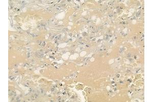 ABIN6262978 and ABIN6276676 at 1/100 staining human normal lung tissue by IHC-P. (LIPC 抗体  (Internal Region))