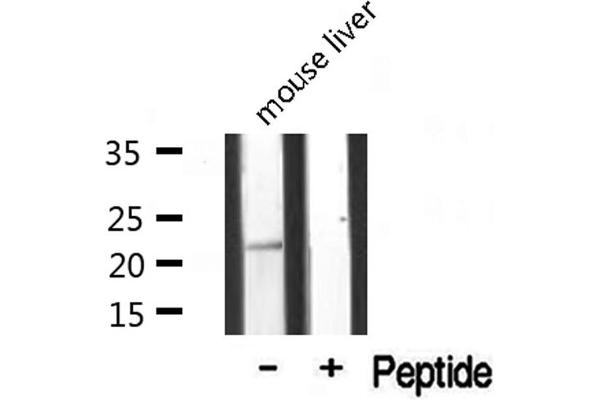 MRPL20 anticorps  (C-Term)
