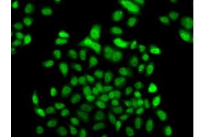 Immunofluorescence analysis of  cells using FBXO7 antibody (ABIN6130383, ABIN6140527, ABIN6140528 and ABIN6223349). (FBXO7 抗体  (AA 353-522))