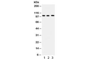 Western blot testing of 1) human HeLa, 2) Raji and 3) U937 lysate with ITCH antibody. (ITCH 抗体)