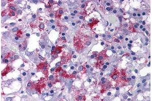 Human Adrenal: Formalin-Fixed, Paraffin-Embedded (FFPE) (EFCAB4B 抗体  (C-Term))