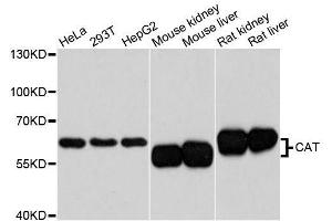 Western blot analysis of extracts of various cell lines, using CAT antibody. (Catalase 抗体  (AA 1-225))