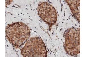 Image no. 5 for anti-DnaJ (Hsp40) Homolog, Subfamily A, Member 2 (DNAJA2) antibody (ABIN1497858)