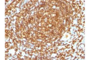 Image no. 2 for anti-CD45RB (CD45RB) antibody (ABIN6170649) (CD45RB 抗体)