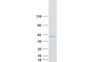 Western Blotting (WB) image for neonatal Fc Receptor (FcRn) (Transcript Variant 1) protein (Myc-DYKDDDDK Tag) (ABIN2720989)