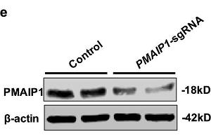 PMAIP1 is a CK-resistant gene. (NOXA 抗体  (AA 1-54))