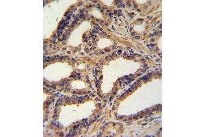 Immunohistochemistry (IHC) image for anti-Natriuretic Peptide A (NPPA) antibody (ABIN2917623) (NPPA 抗体)