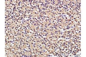 Immunohistochemistry (Paraffin-embedded Sections) (IHC (p)) image for anti-CD19 Molecule (CD19) (AA 151-250) antibody (ABIN1387313)
