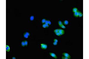 Immunofluorescent analysis of HepG2 cells using ABIN7143348 at dilution of 1:100 and Alexa Fluor 488-congugated AffiniPure Goat Anti-Rabbit IgG(H+L) (Adenylate Kinase 5 抗体  (AA 61-215))