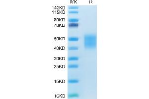 CD28 (CD28) (AA 18-153) protein (His tag)