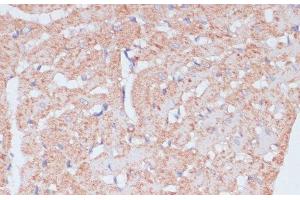 Immunohistochemistry of paraffin-embedded Rat heart using MZB1 Polyclonal Antibody at dilution of 1:100 (40x lens). (MZB1 抗体)