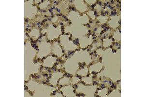 Immunohistochemistry of paraffin-embedded Mouse lung using RNGTT antibody at dilution of 1:100 (x400 lens). (RNGTT 抗体)