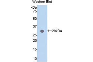 Western blot analysis of the recombinant protein. (MYD88 抗体  (AA 32-265))