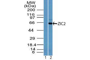 Image no. 1 for anti-ZIC2 (ZIC2) (AA 350-400) antibody (ABIN960412) (ZIC2 抗体  (AA 350-400))