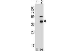 Western Blotting (WB) image for anti-Cyclin-Dependent Kinase 3 (CDK3) antibody (ABIN2997548) (CDK3 抗体)