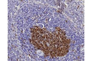 Immunohistochemistry analysis of paraffin-embedded rat spleen using Survivin Polyclonal Antibody at dilution of 1:300. (Survivin 抗体)
