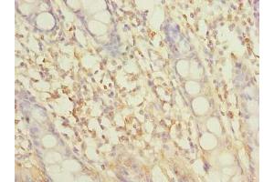 Immunohistochemistry of paraffin-embedded human colon tissue using ABIN7162305 at dilution of 1:100 (SLC6A16 抗体  (AA 1-138))