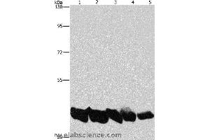 Western blot analysis of A549 and hela cell, mouse liver and human liver tissue, hepG2 cell, using PGK1 Polyclonal Antibody at dilution of 1:850 (PGK1 抗体)