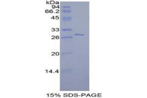 SDS-PAGE analysis of Mouse STAT6 Protein. (STAT6 蛋白)
