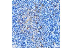 Immunohistochemistry of paraffin-embedded mouse spleen using PSMD10 antibody  at dilution of 1:100 (40x lens). (PSMD10 抗体  (AA 1-226))