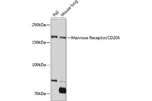 Western blot analysis of extracts of various cell lines, using Mannose Receptor/CD206 Rabbit mAb (ABIN7268388) at 1:1000 dilution. (Macrophage Mannose Receptor 1 抗体)