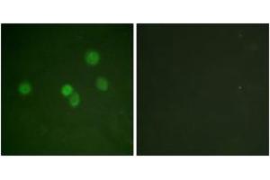 Immunofluorescence analysis of A549 cells, using SP1 (Ab-453) Antibody. (SP1 抗体  (AA 421-470))