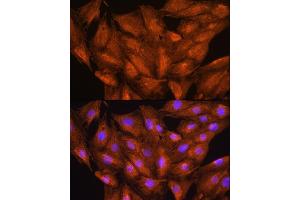 Immunofluorescence analysis of H9C2 cells using D Rabbit pAb (ABIN6127743, ABIN6139383, ABIN6139384 and ABIN6223348) at dilution of 1:100. (DAAM2 抗体  (AA 1-86))