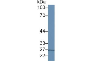 Western Blot; Sample: Porcine Liver lysate; Primary Ab: 2µg/ml Rabbit Anti-Human IL13Ra1 Antibody Second Ab: 0. (IL13 Receptor alpha 1 抗体  (AA 137-210))