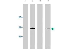 Western blot analysis using VSX2 polyclonal antibody at 1 ug/mL on rat liver (lane 1), retina tissue lysate (lane 2), mouse liver (lane 3) and retina (lane 4) tissue lysate. (VSX2 抗体  (AA 1-131))
