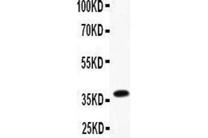 Western Blotting (WB) image for anti-Fc Fragment of IgE, Low Affinity II, Receptor For (CD23) (FCER2) (AA 50-331) antibody (ABIN3043829)