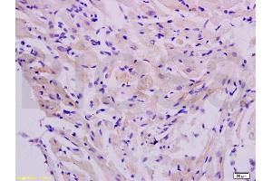 Formalin-fixed and paraffin embedded rat heart labeled with Anti-FLIP Polyclonal Antibody, Unconjugated (ABIN737946) at 1:200 followed by conjugation to the secondary antibody and DAB staining. (FLIP 抗体  (AA 401-480))