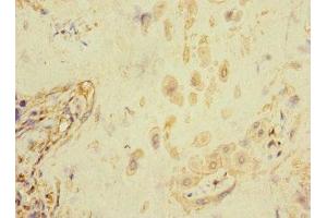 Immunohistochemistry of paraffin-embedded human placenta tissue using ABIN7152671 at dilution of 1:100 (FCRL6 抗体  (AA 20-307))