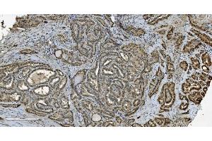 IHC analysis of Transketolase/TKT using anti-Transketolase/TKT antibody (ABIN7598958).