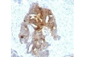 Immunohistochemistry (IHC) image for anti-Temporarily Assigned Gene Name Family Member (TAG-72) antibody (ABIN3026694)