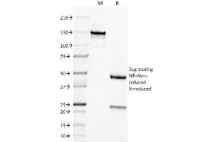 SDS-PAGE Analysis of Purified Chromogranin A Monoclonal Antibody (LK2H10). (Chromogranin A 抗体)