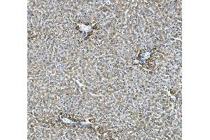 IHC analysis of Glycine decarboxylase/GLDC using anti-Glycine decarboxylase/GLDC antibody (ABIN7602073). (GLDC 抗体  (AA 574-1020))