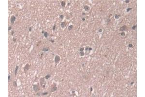Immunohistochemistry (IHC) image for anti-Aminoadipate Semialdehyde Synthase (AASS) (AA 33-455) antibody (ABIN7444178)