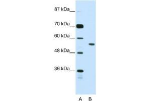WB Suggested Anti-BRD3 Antibody Titration:  2. (BRD3 抗体  (N-Term))