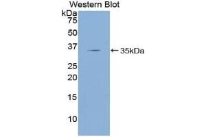 Western blot analysis of the recombinant protein. (KLF4 抗体  (AA 187-474))