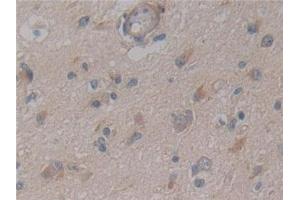 Immunohistochemistry (IHC) image for anti-Nuclear Factor kappa B (NFkB) (AA 805-892) antibody (ABIN7442525)