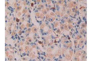 Detection of TGFa in Human Kidney Tissue using Polyclonal Antibody to Transforming Growth Factor Alpha (TGFa) (TGFA 抗体  (AA 24-98))