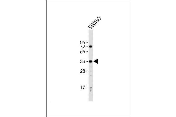 PRSS23 anticorps  (AA 156-191)