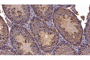 Immunohistochemistry (IHC) image for anti-Meningioma Expressed Antigen 5 (Hyaluronidase) (MGEA5) (AA 319-450) antibody (ABIN7438487)