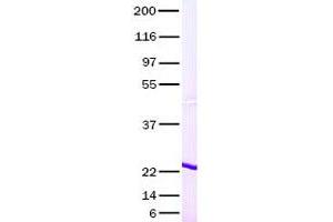 Validation with Western Blot